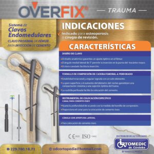Sistema de clavos endomedulares