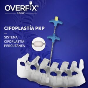 CIFOPLASTÍA PKP